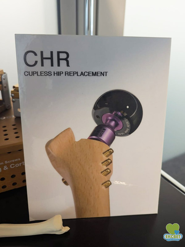 Імпланти KYON для операцій CHR