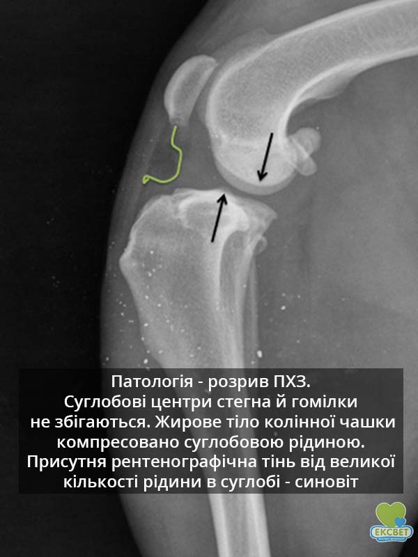 Рентген коліна собаки. Патологія - розрив ПХЗ. Суглобові центри стегна й гомілки не збігаються. Жирове тіло колінної чашки компресовано суглобовою рідиною. Присутня рентенографічна тінь від великої кількості рідини в суглобі - синовіт