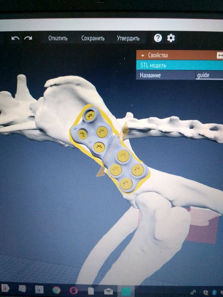 3D модель импланта