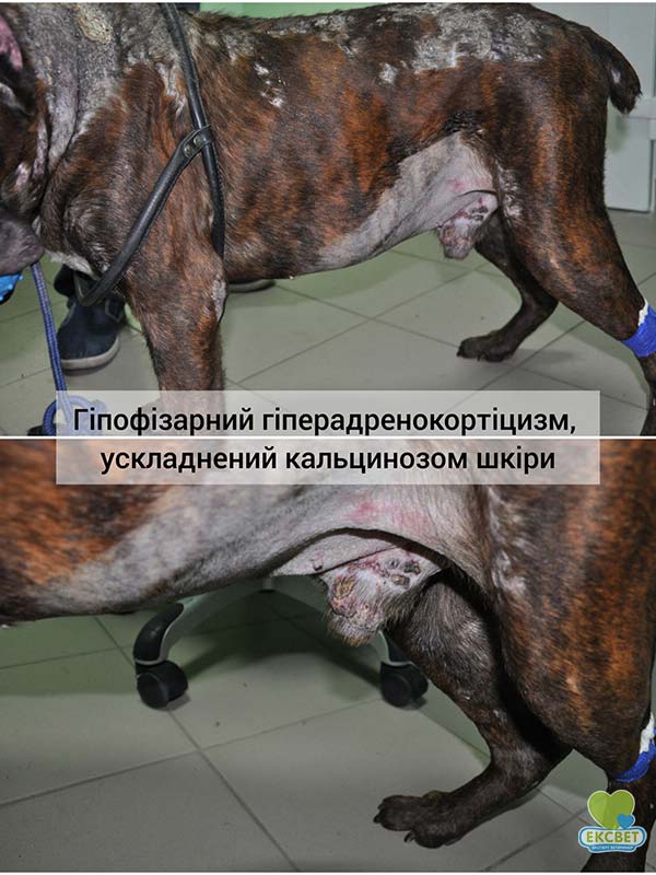 Гіпофізарний гіперадренокортицизм