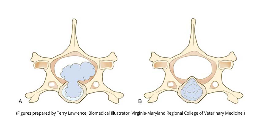 Хвороба дисків Тип Хансен I&nbsp;(А)&nbsp;и Хансен II&nbsp;(В)&nbsp;IVDD&nbsp;https://veteriankey.com/intervertebral-disk-disease/