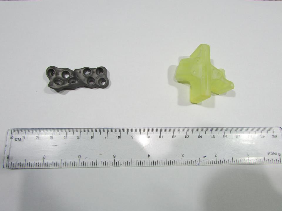 3D модель импланта