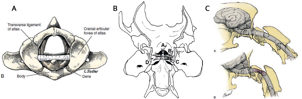 Поперечна зв'язка атланта (transverse ligament of atlas) - схема