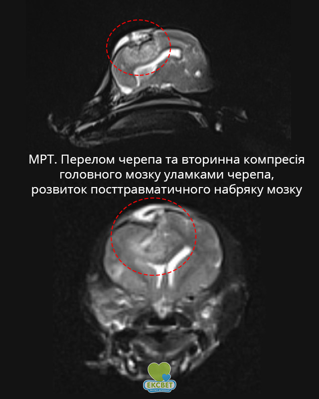 МРТ голови собаки. Перелом кістокк черепа  та вторинна компресія головного мозку